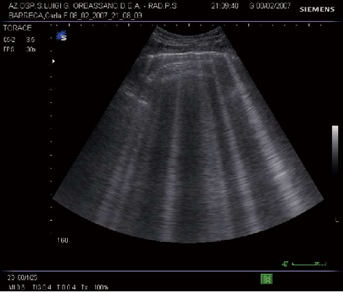 Lung Ultrasound Image